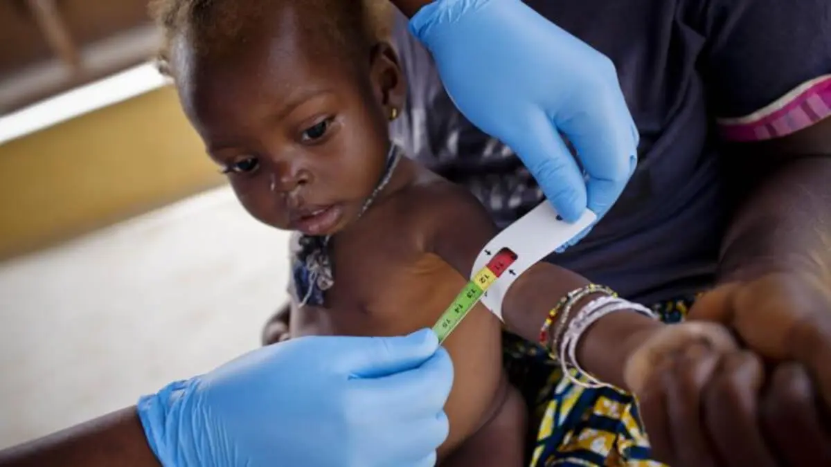 Mariama Lansanna, de 35 años, sostiene a su bebé Hawa, que muestra signos de desnutrición.<br />
© UNICEF/UN011617/Holt