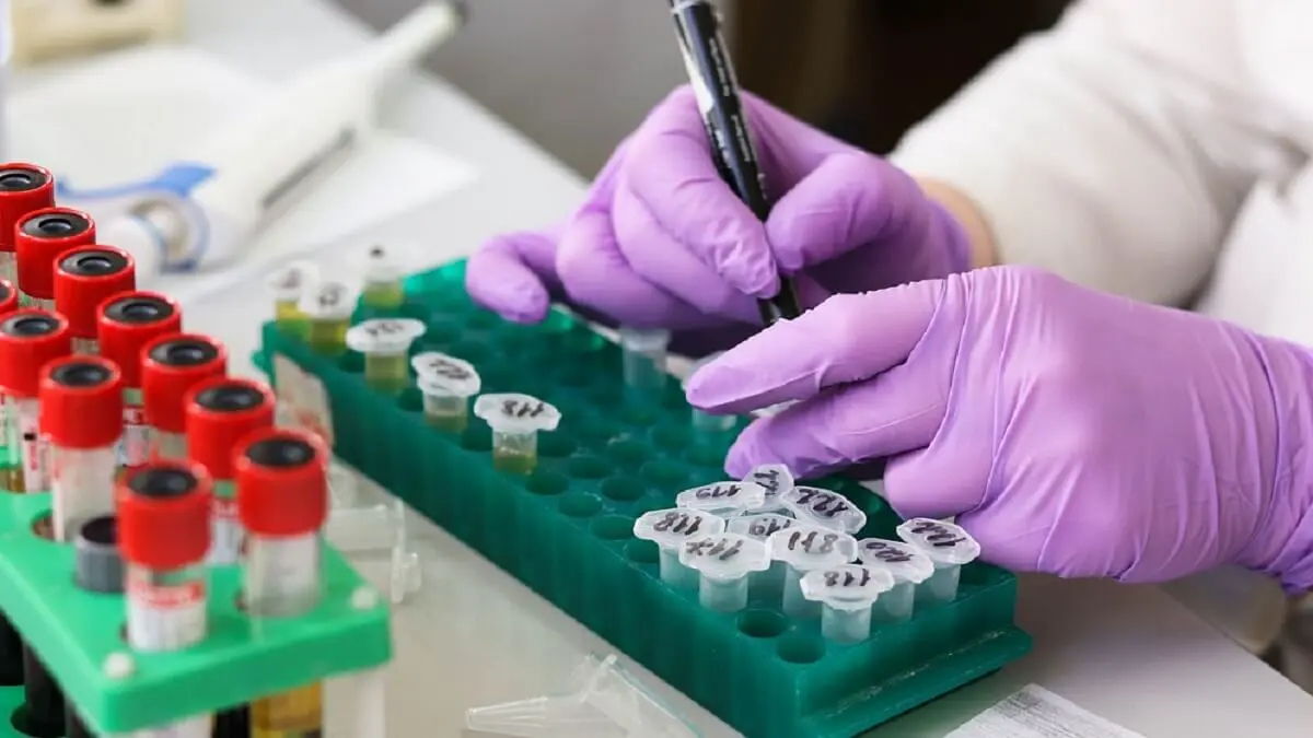 <a target="_blank" href="https://pixabay.com/photos/laboratory-medical-medicine-hand-3827745/">Laboratorio</a> - PHOTO/PIXABAY