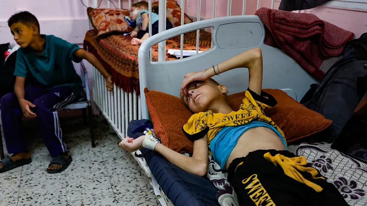 <p>La ni&ntilde;a palestina Huda Abu Al-Naja yace en una cama mientras recibe tratamiento en la sala de desnutrici&oacute;n del hospital Nasser en Khan Younis, sur de la Franja de Gaza, el 5 de agosto de 2025 - REUTERS/ HATEM KHALED</p>
