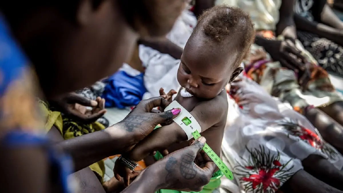 Medici&oacute;n del nivel de malnutrici&oacute;n de un ni&ntilde;o en un campo de refugiados de Etiop&iacute;a - PHOTO/Fundaci&oacute;n "la Caixa"