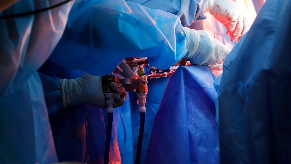 El proyecto CaixaResearch Placenta Artificial logra una supervivencia de 12 días con buen estado fetal. © Fundación ”la Caixa”