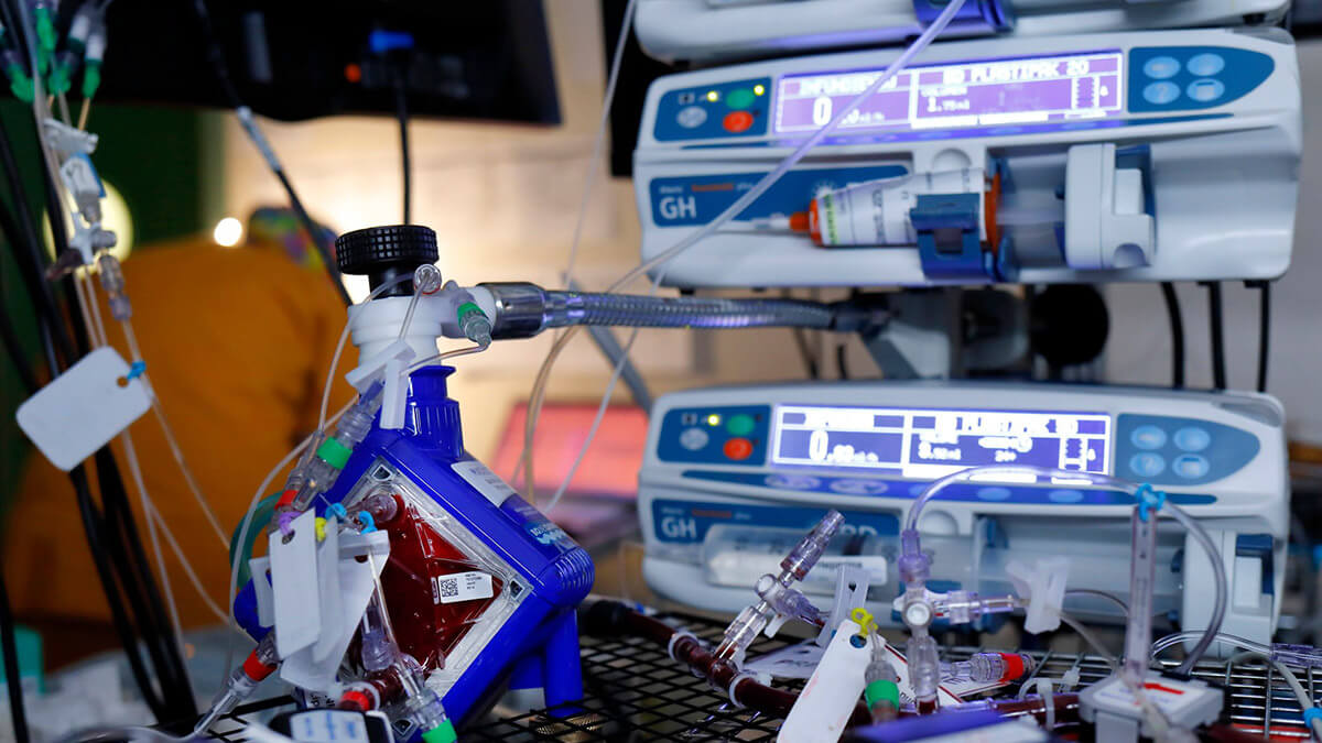 El proyecto CaixaResearch Placenta Artificial logra una supervivencia de 12 días con buen estado fetal. © Fundación ”la Caixa”