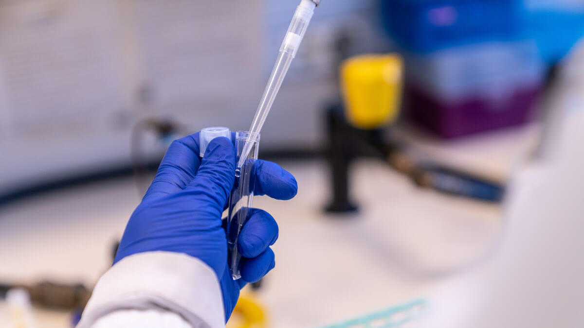 Estudio realizado por la Unidad de covid persistente del Hospital Germans Trias, la Fundación Lucha contra las Infecciones y el Instituto de Investigación del Sida IrsiCaixa.