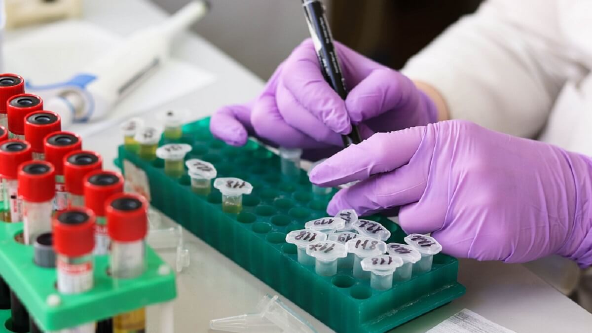 <a target="_blank"  data-cke-saved-href="https://pixabay.com/photos/laboratory-medical-medicine-hand-3827745/" href="https://pixabay.com/photos/laboratory-medical-medicine-hand-3827745/">Laboratorio</a> - PHOTO/PIXABAY
