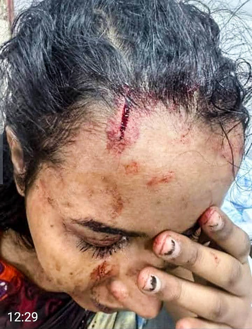 Agresiones a estudiantes saharauis en Argelia - ASADEDH