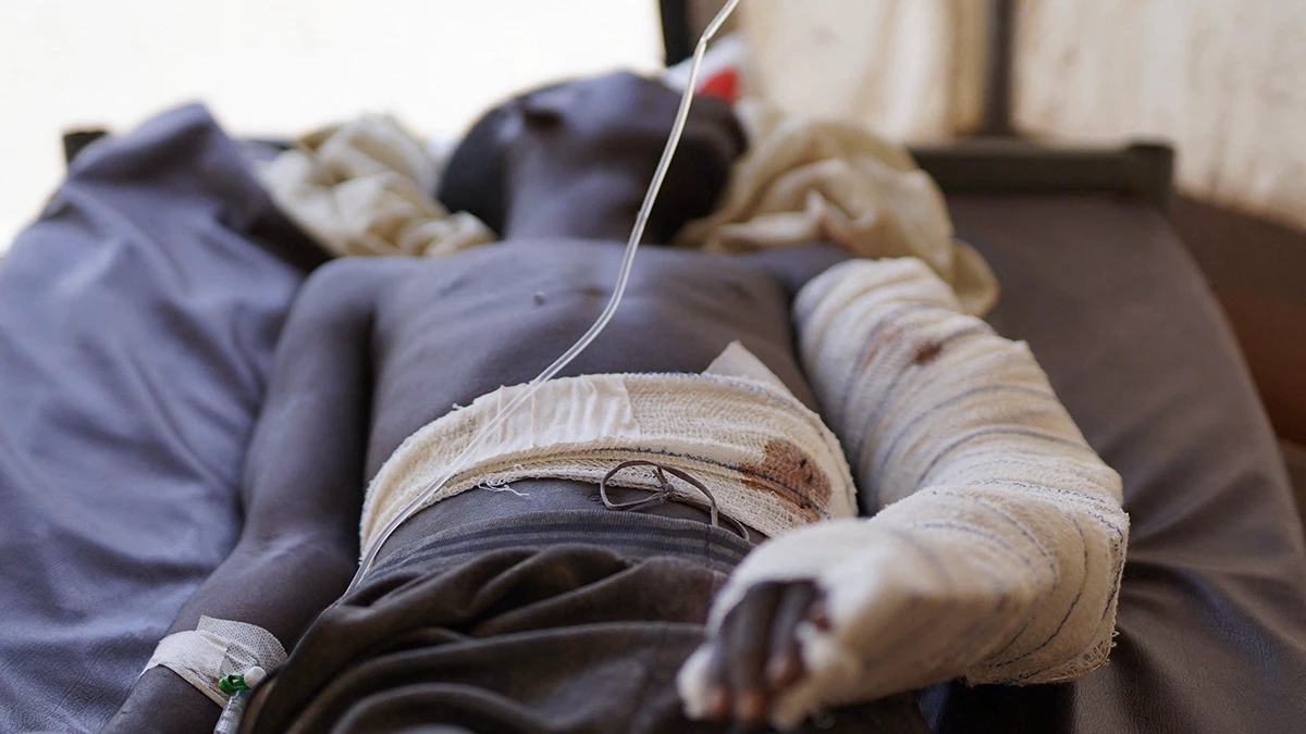 <p>Clínica improvisada gestionada por Médicos Sin Fronteras (MSF), en medio de los continuos enfrentamientos entre las Fuerzas de Apoyo Rápido (RSF) paramilitares y el Ejército sudanés, en Tawila, Darfur del Norte, Sudán, el 3 de noviembre de 2025 - REUTERS/ MOHAMED JAMAL</p>
